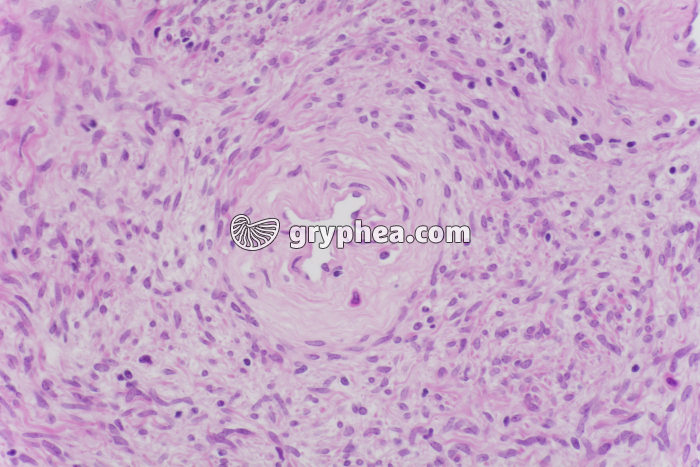 Prostate x100 - gryphea.com